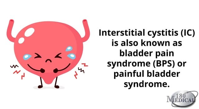 interstitial cystitis is also known as bladder pain syndrome bps