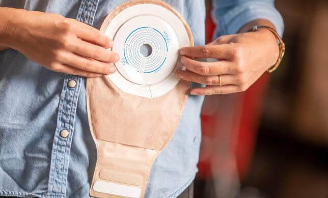 hands holding a one-piece cut-to-fit drainable ostomy pouching system