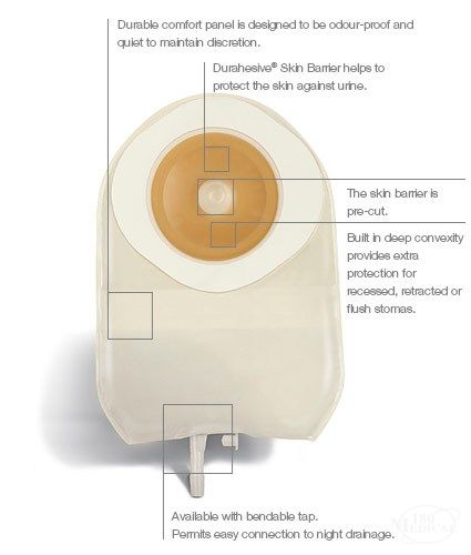 ConvaTec ActiveLife One-Piece Convex Urostomy Pouch features