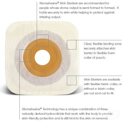 ConvaTec Esteem Synergy Stomahesive Skin Barrier features