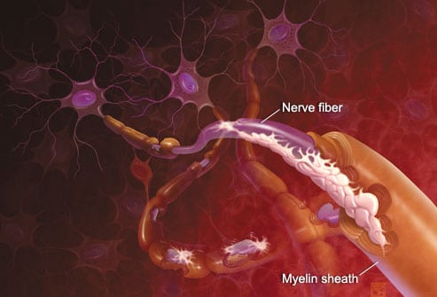illustration of myelin sheath over nerve fibers