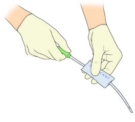 applying sterile lubricant to a catheter