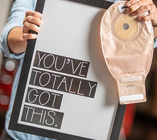 Employee holding sign and ostomy pouch and sign says you've totally got this