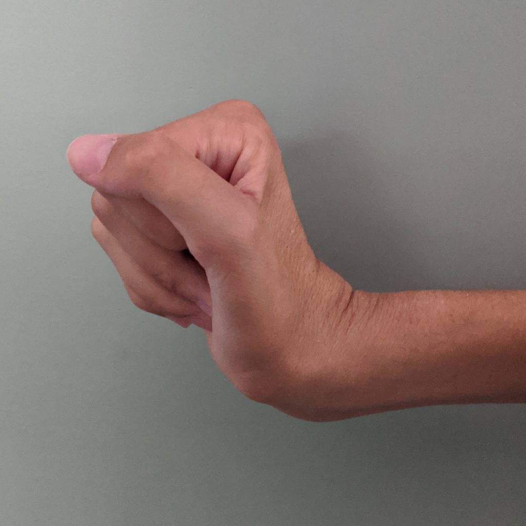 wrist extension tenodesis