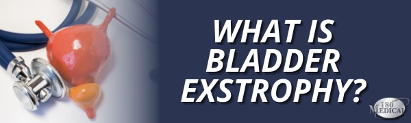 what is bladder exstrophy