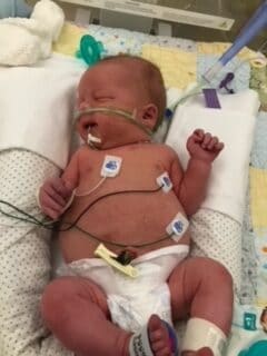 Cooper as a baby in the NICU