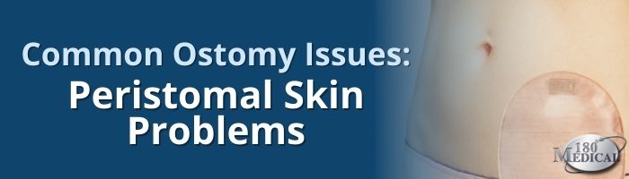 Common Ostomy Issues - Peristomal Skin Problems