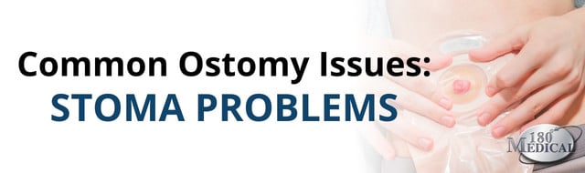 Common Ostomy Issues Stoma Problems
