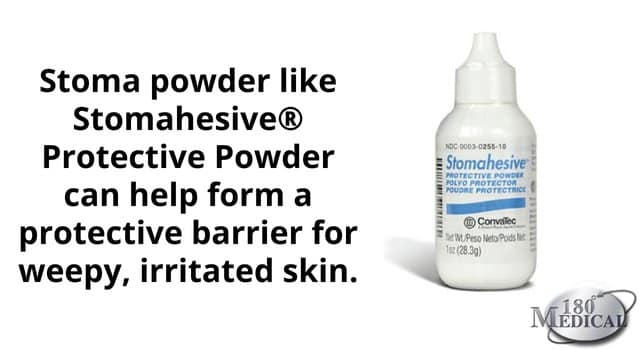 stomahesive protective powder can help form a protective barrier for weepy skin