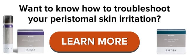 troubleshoot your peristomal skin irritation issues