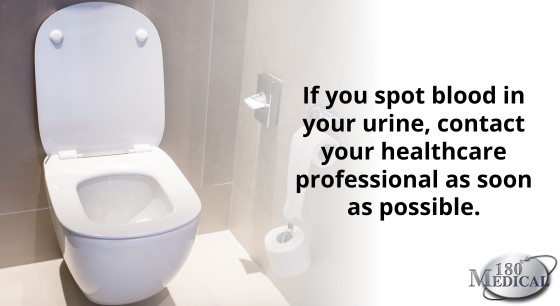 If you spot blood in your urine, contact your healthcare professional as soon as possible.